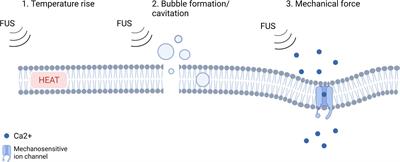 Recent Advances in the Use of Focused Ultrasound as a Treatment for Epilepsy